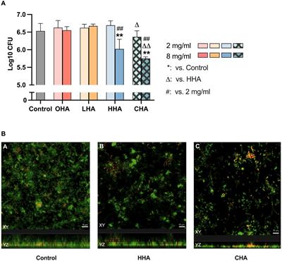 In-vitro effects of different hyaluronic acids on periodontal biofilm-immune cell interaction